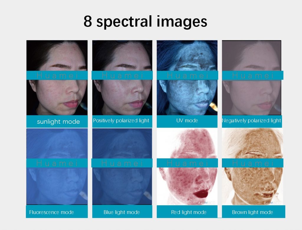 I-Skin-imaging-analyzer-3-1024x781